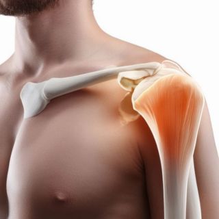 Sostenere il recupero e il benessere delle articolazioni